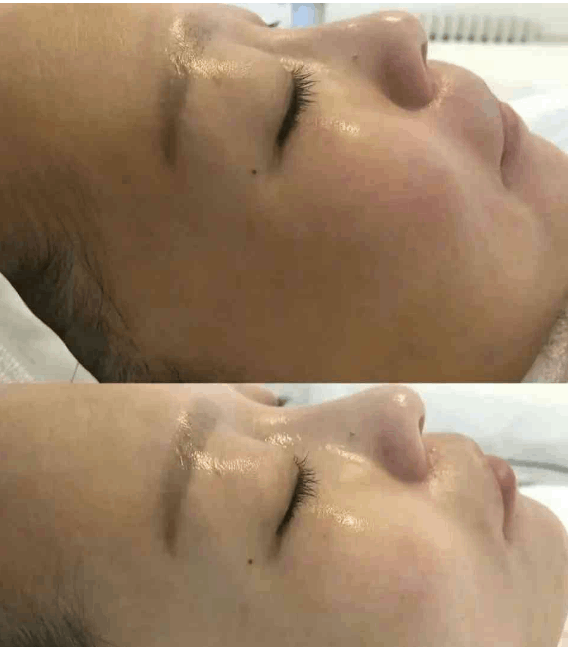 皮膚補水之後會讓人看起來更透亮